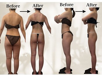 リリーシャ 赤坂(LILISHA)/骨格ウェーブの脚細くヒップUP!