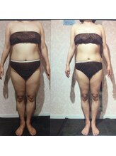 パーフェクトボディプレミアム 大阪難波店(PERFECT BODY PREMIUM)/お客様　ビフォーアフター（32）