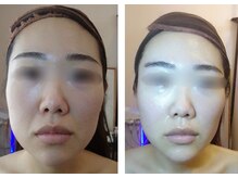 りた/骨格矯正＆たるみケア