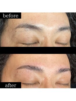 ユー 千葉駅前店(you)/症例写真