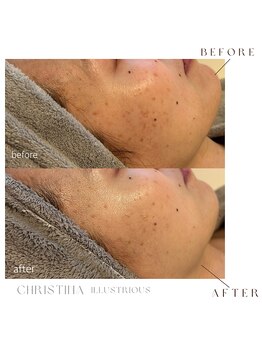 シェア(share.)/クリスティーナ　イラストリアス