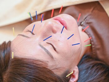 すばる屋/美容鍼でリストアップ