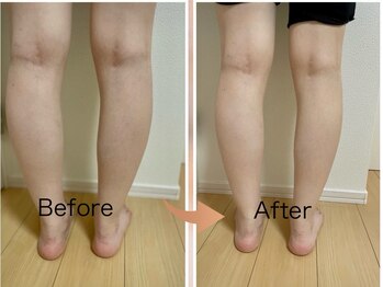 ヨサパーク レイ 等々力(YOSA PARK Ray)/お客様の変化　水素コース2回目