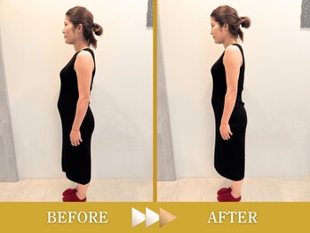 ビアンカ 目黒本院(Bianca)/妊娠中のマイナートラブルにも★