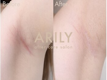 アリリィ(ARILY)/ARILY after care salon