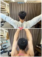 BP鍼灸整骨院/施術前後の可動域の変化 1