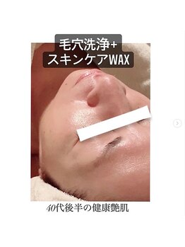 マイン 幸店/水素毛穴洗浄！