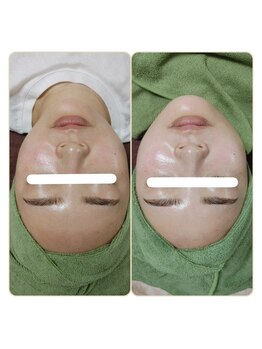 アンティクイーン(Antiqueen)/ワンランク上のお肌へ