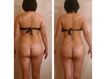 アンドゥ 津田沼(Undo)/結果のでる痩身エステはこれ!