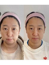 小顔22 ボルティ 本店(Bolty)/小顔シンメトリー矯正＆全身矯正