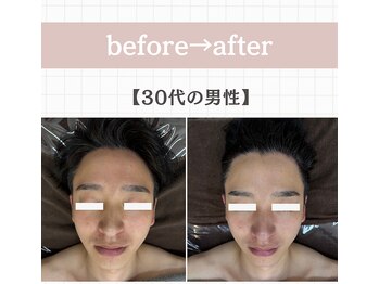 ジェイド(Jade)/初回のbefore→after