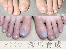 爪悩み専門店の雰囲気（爪のコンプレックスを解消し理想の爪へ。深爪矯正）