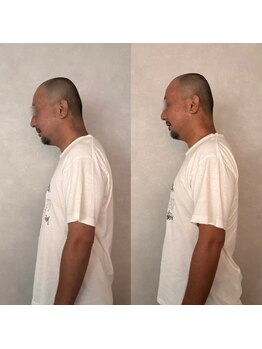 ジュビレ/整頭ヘッドスパ