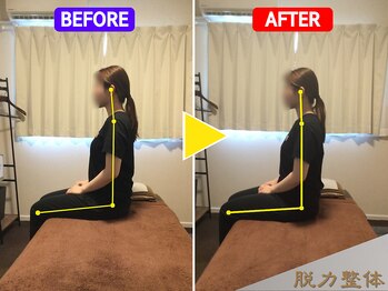 幸せのもり整体院/20代女性/Yさん