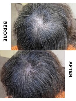 ターミナルジム アンド ビューティーサロン(TERMINAL GYM&BEAUTY SALON)/頭皮ペイント 頭頂