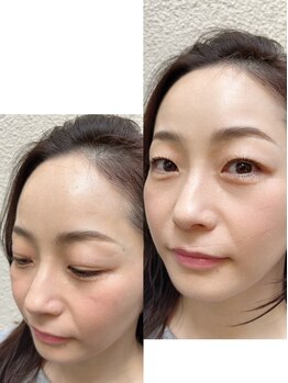 十色 中目黒店/【ハリウッドブロウリフト】