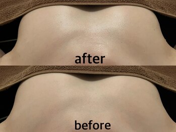 整顔整頭/【ふわふわ天使のバスト】