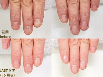 【地爪育成 症例 4】