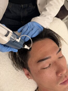 アンノン(Annon)の写真/【生え際、毛量、ハリコシ不足】育毛促進成分を毛根に直接導入＆頭皮環境を整える本気の育毛促進プログラム