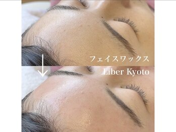エステティック リベル キョウト 京都駅前店(Esthetic Liber Kyoto)/フェイスワックス脱毛