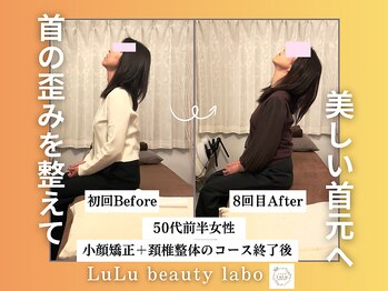 ルルラボ(LuLu beauty labo)/スマホ首解消で首が長く見える