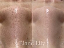 ブランリリー(Blanc Lily)の雰囲気（症例数多数有り◎ニキビケア、毛穴、シミ、乾燥あらゆる肌悩みに）