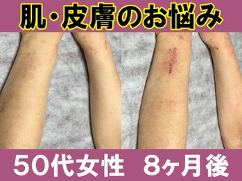 ユリシード 大阪分院(Ulyseeed)/PREMIUMイヌトウキでスッキリ♪