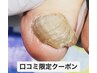 ◆ご新規HPB&Google口コミ割★1,000円OFF ◆【肥厚爪ケア】￥10,000/2本