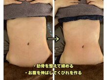 ラフ(laugh)/お腹施術