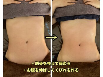 ラフ(laugh)/お腹施術