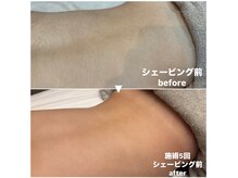 リミー(Reme)/日焼け肌・敏感肌OK♪