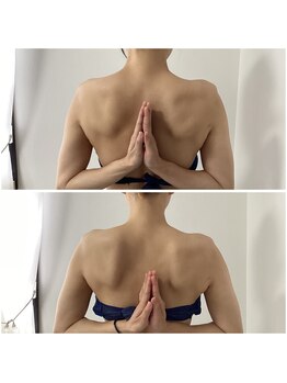 ポラス(Polus)/ブライダル/ポラス式肩甲骨ケア