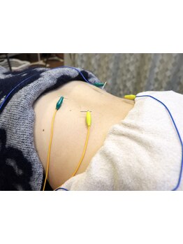 接骨院・整骨院で施術を受けたい