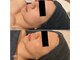 テトテ(TEtoTE)の写真