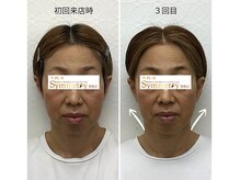 なさき整骨院プラスシンメトリー 豊橋店の雰囲気(お顔の土台の首の歪みを整え、頬もたるみも改善!気持ちも上がる)