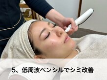 ラウレア(LAULEA)/5：低周波ペンシルでシミ改善