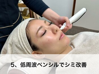 ラウレア(LAULEA)/5：低周波ペンシルでシミ改善