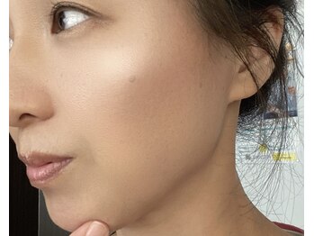 バーテックスキー(Vertexkey)/フェイスライン