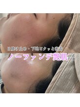 ホワイトワックス 難波店(WHITE WAX)/ノーファンデ艶肌♪