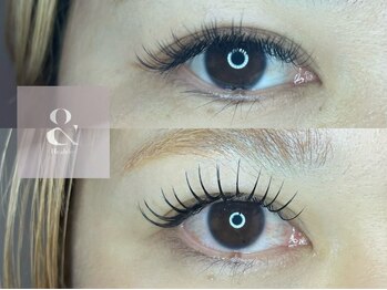 グランウィーユ バイ ロンド 銀座(Grand oeil by Lond)/【mizuki】アンドヘルシー