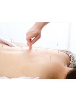 鍼灸施術を受けたい