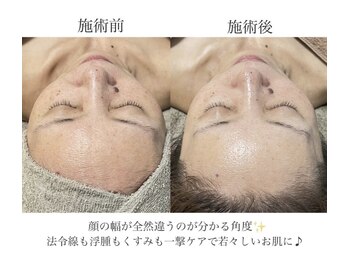 クレヴィー(Creviy)/最先端の細胞美容コース