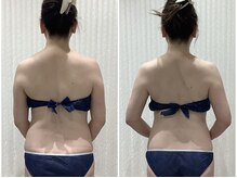 エスアール アミティ(SR Amity)/キャビ2部位／左Before・右After