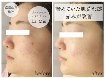 ラミーユ(La Miu)