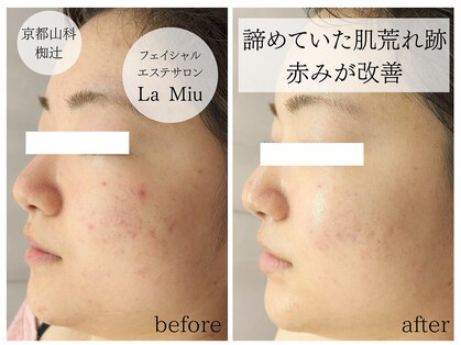 ラミーユ(La Miu)の写真