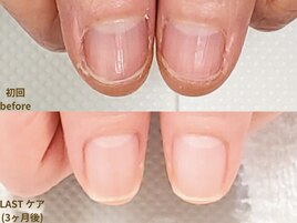 【地爪育成 症例 4】