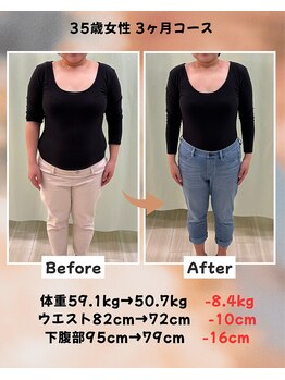 くさば整骨院/35歳女性/ダイエット3か月コース