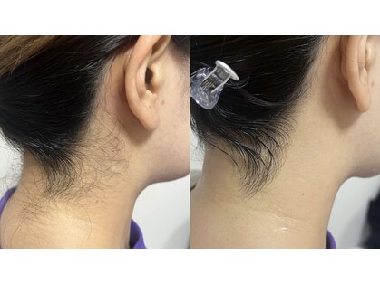 リュール(Lueur)の写真