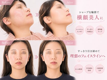 クアダ 天神(QUADA)の写真