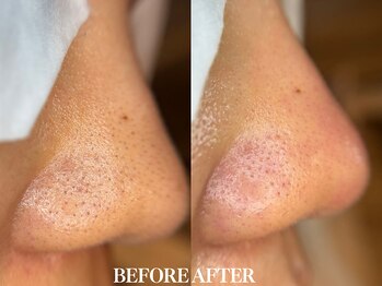 サロン ムスブ(salon MUSUBU)/山梨エステ/甲府エステ